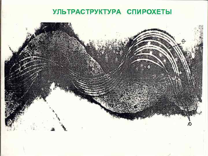 УЛЬТРАСТРУКТУРА СПИРОХЕТЫ 