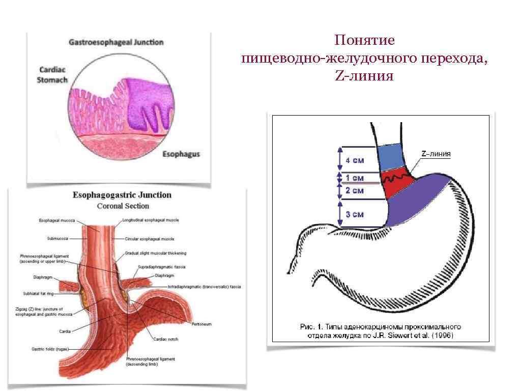 Складки пищевода. Анатомия пищеводно-желудочного соединения. Кардиоэзофагеальный отдел желудка. Зубчатая линия пищевода.