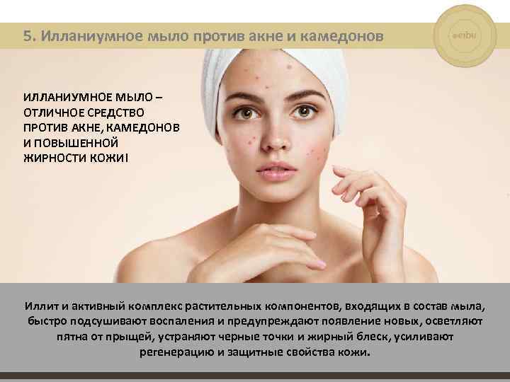 5. Илланиумное мыло против акне и камедонов ИЛЛАНИУМНОЕ МЫЛО – ОТЛИЧНОЕ СРЕДСТВО ПРОТИВ АКНЕ,