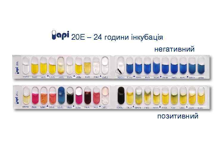 20 E – 24 години інкубація негативний позитивний 