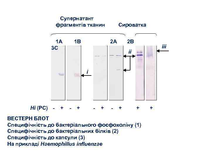 Супернатант фрагментів тканин 1 A 3 C 1 B Сироватка 2 A 2 B