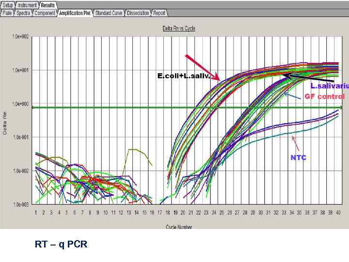 RT – q PCR 