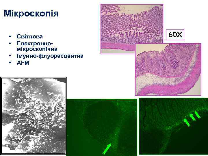 Мікроскопія • Світлова • Електронномікроскопічна • Імунно-флуоресцентна • AFM 60 X 