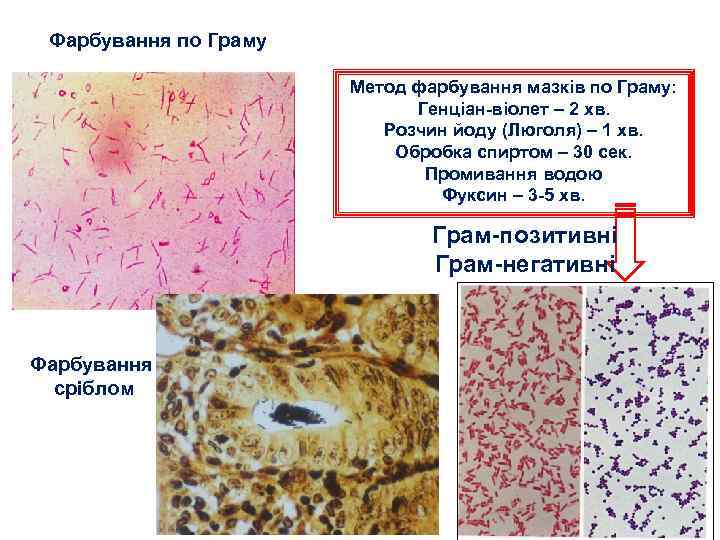 Фарбування по Граму Метод фарбування мазків по Граму: Генціан-віолет – 2 хв. Розчин йоду