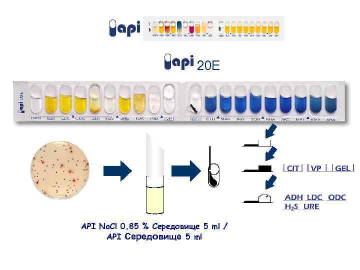 20 E API Na. Cl 0. 85 % Середовище 5 ml / API Середовище