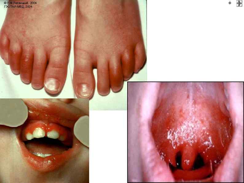 © П. Ф. Литвицкий, 2004 ГЭОТАР-МЕД, 2004 © 