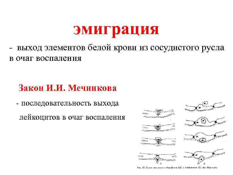 эмиграция - выход элементов белой крови из сосудистого русла в очаг воспаления Закон И.