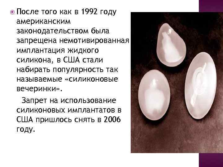  После того как в 1992 году американским законодательством была запрещена немотивированная имплантация жидкого