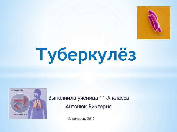 Туберкулёз Выполнила ученица 11 -А класса Антонюк Виктория Ильичевск, 2012 