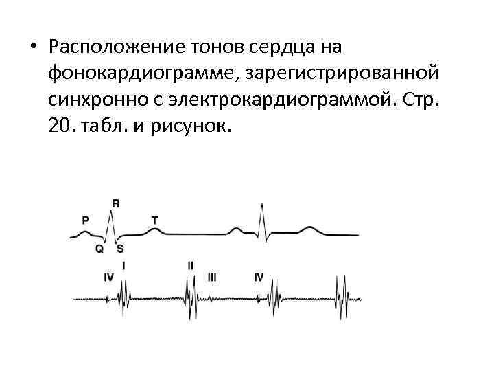  • Расположение тонов сердца на фонокардиограмме, зарегистрированной синхронно с электрокардиограммой. Стр. 20. табл.