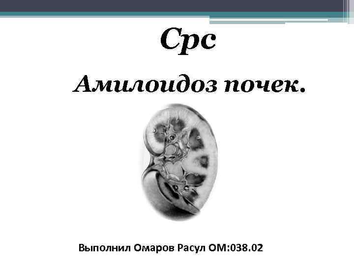 Срс Амилоидоз почек. Выполнил Омаров Расул ОМ: 038. 02 