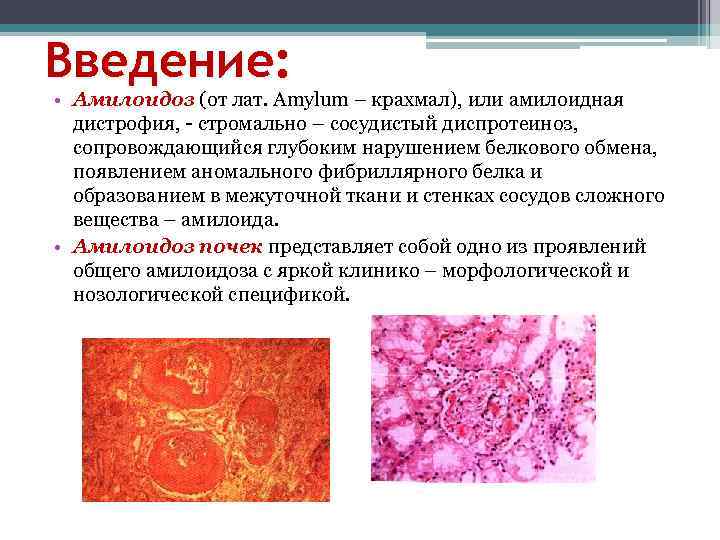 Амилоидоз почек презентация