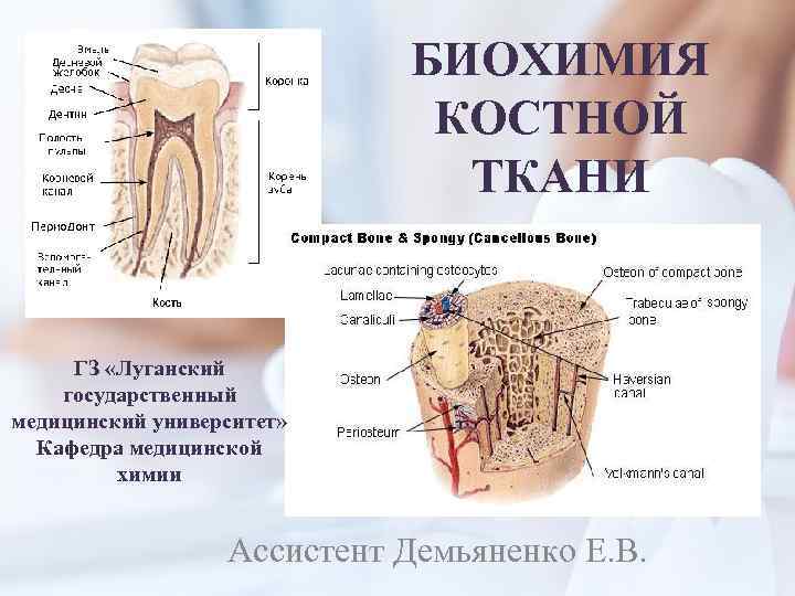 БИОХИМИЯ КОСТНОЙ ТКАНИ ГЗ «Луганский государственный медицинский университет» Кафедра медицинской химии Ассистент Демьяненко Е.