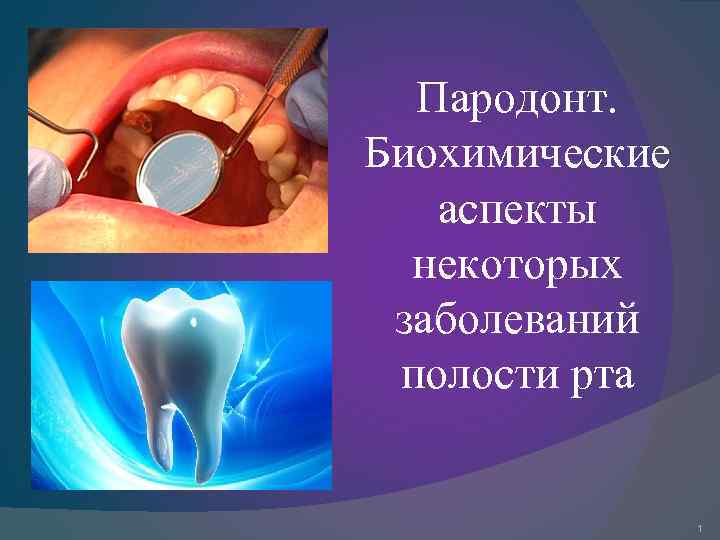 Пародонт. Биохимические аспекты некоторых заболеваний полости рта 1 