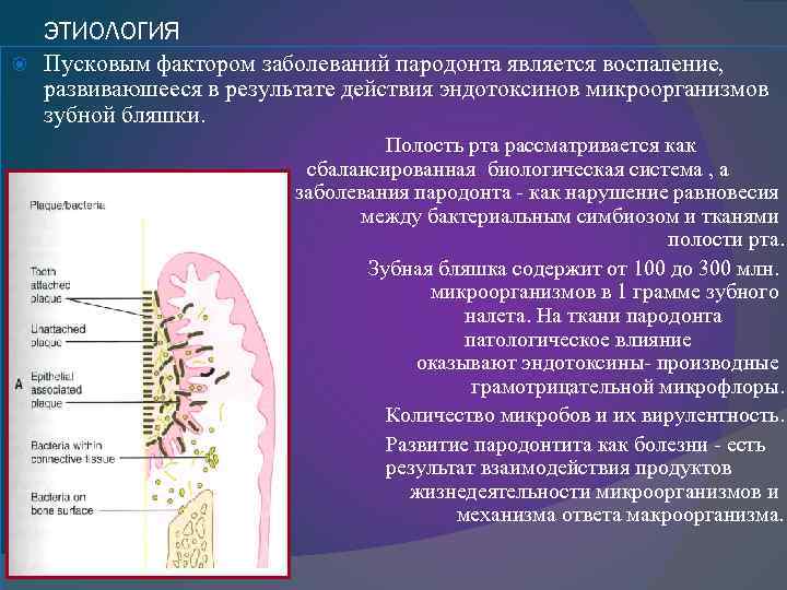 ЭТИОЛОГИЯ Пусковым фактором заболеваний пародонта является воспаление, развиваюшееся в результате действия эндотоксинов микроорганизмов зубной