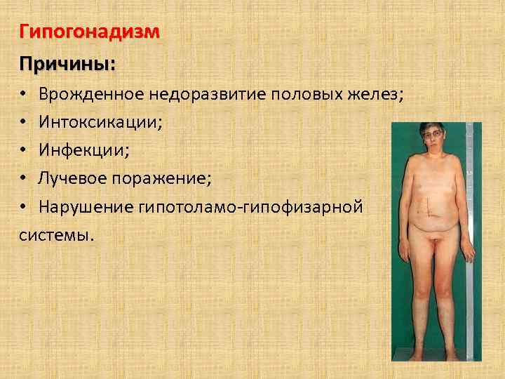 Гипогонадизм Причины: • Врожденное недоразвитие половых желез; • Интоксикации; • Инфекции; • Лучевое поражение;