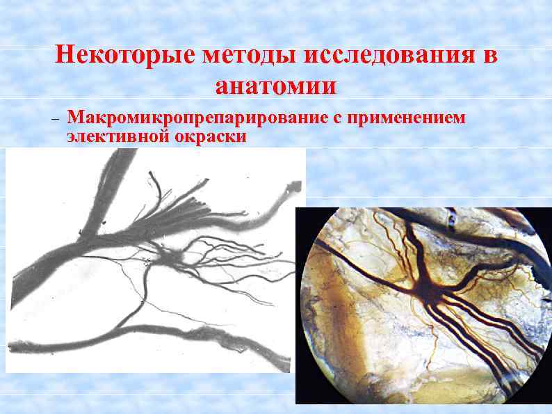 Некоторые методы исследования в анатомии Макромикропрепарирование с применением элективной окраски 