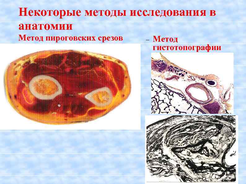 Некоторые методы исследования в анатомии Метод пироговских срезов Метод гистотопографии 