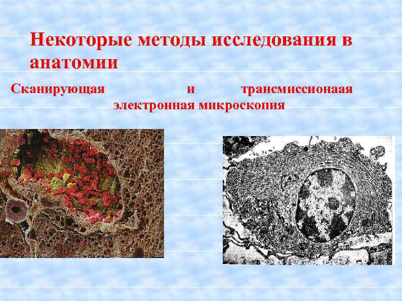 Некоторые методы исследования в анатомии Сканирующая и трансмиссионаая электронная микроскопия 