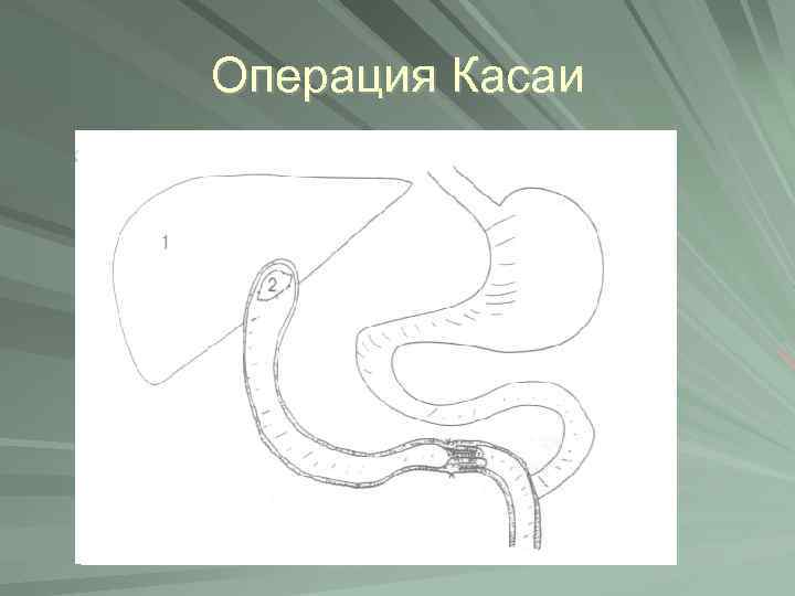 Операция Касаи 