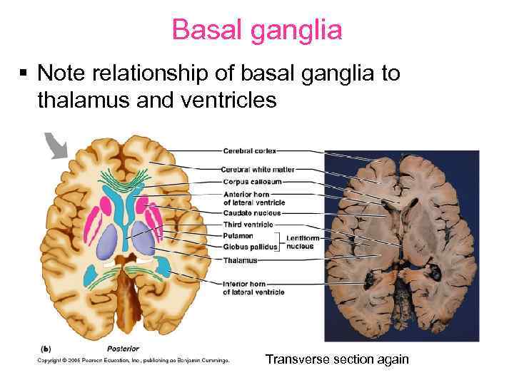 Basal ganglia § Note relationship of basal ganglia to thalamus and ventricles Transverse section