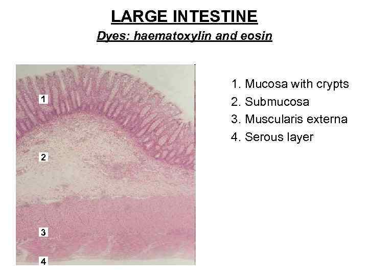 LARGE INTESTINE Dyes: haematoxylin and eosin 1 2 3 4 1. Mucosa with crypts