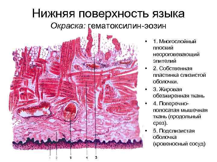 Нижняя поверхность языка Окраска: гематоксилин-эозин • • • 1. Многослойный плоский неороговевающий эпителий 2.