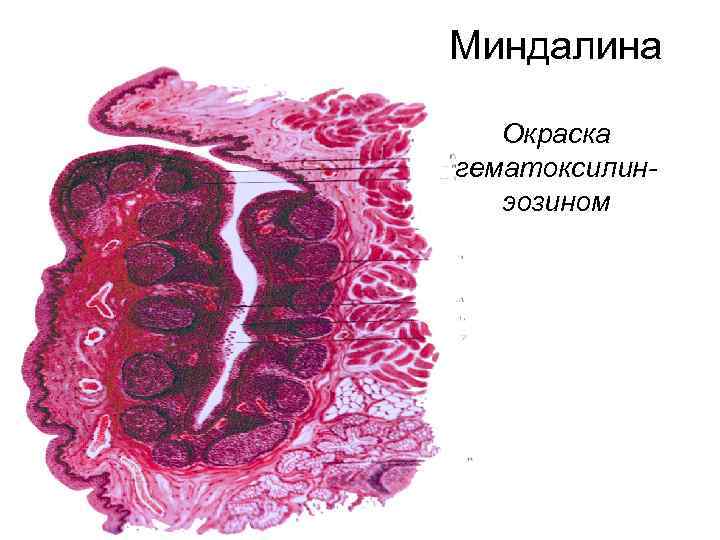 Миндалина Окраска гематоксилинэозином 