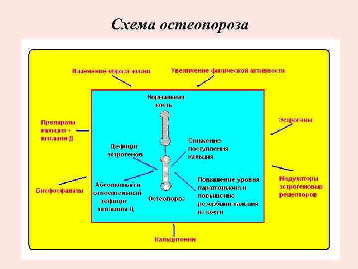 Схема остеопороза 