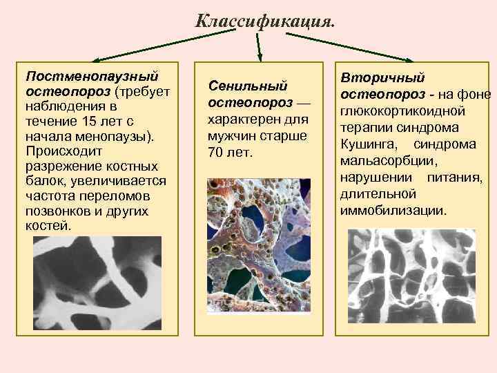 Классификация. Постменопаузный остеопороз (требует наблюдения в течение 15 лет с начала менопаузы). Происходит разрежение