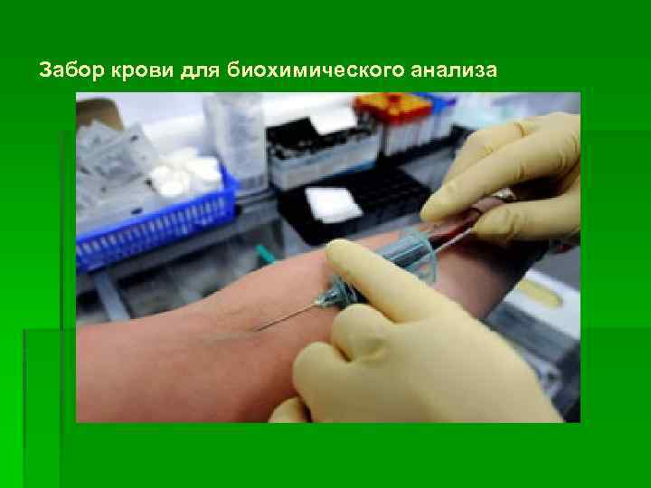 Забор крови для биохимического анализа 
