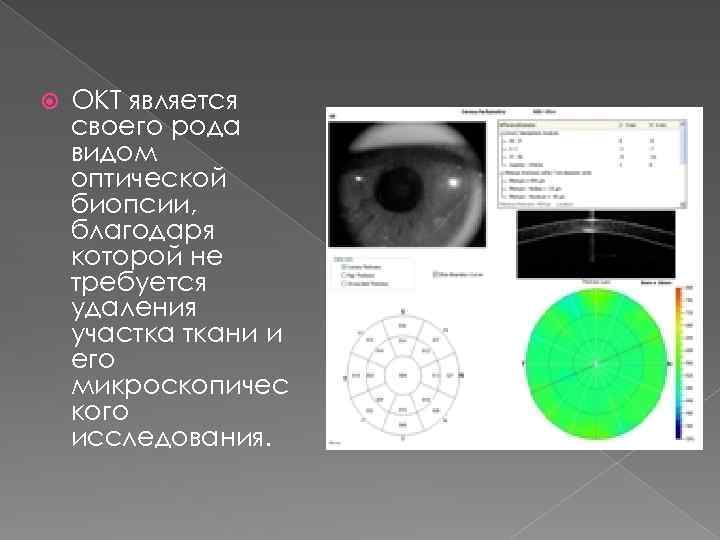  ОКТ является своего рода видом оптической биопсии, благодаря которой не требуется удаления участка