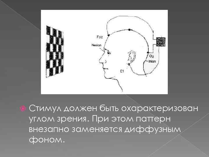  Стимул должен быть охарактеризован углом зрения. При этом паттерн внезапно заменяется диффузным фоном.