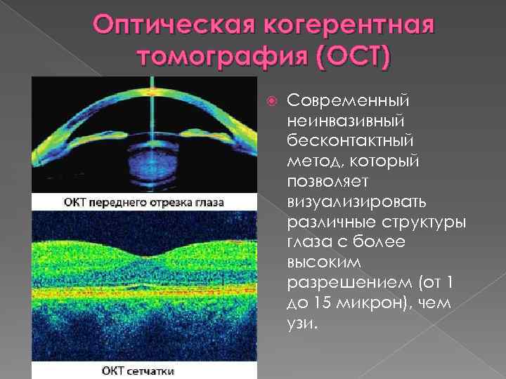 Оптическая когерентная томография (OCT) Современный неинвазивный бесконтактный метод, который позволяет визуализировать различные структуры глаза