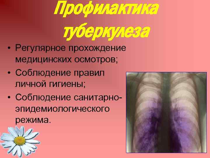 Профилактика туберкулеза • Регулярное прохождение медицинских осмотров; • Соблюдение правил личной гигиены; • Соблюдение