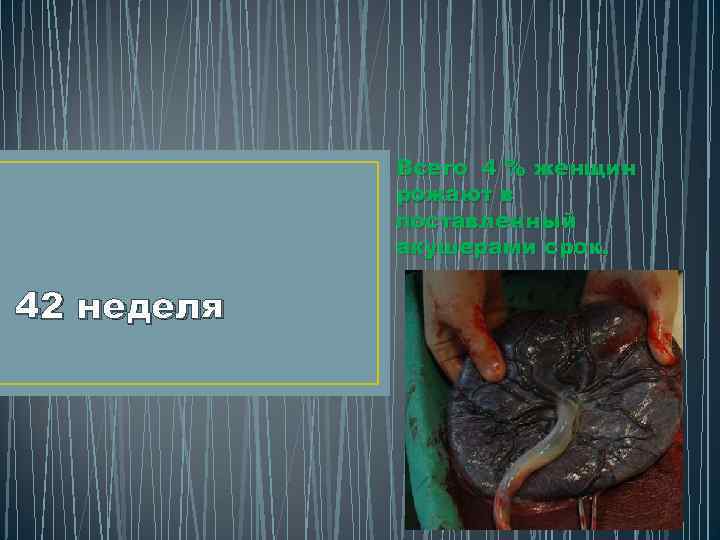 Всего 4 % женщин рожают в поставленный акушерами срок. 42 неделя 