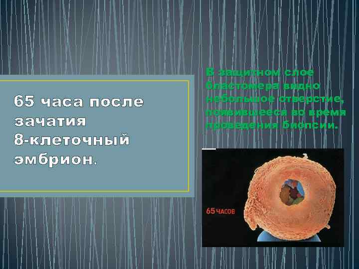 65 часа после зачатия 8 -клеточный эмбрион. В защитном слое бластомера видно небольшое отверстие,