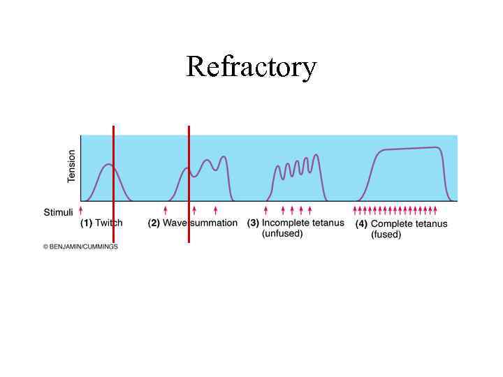 Refractory 