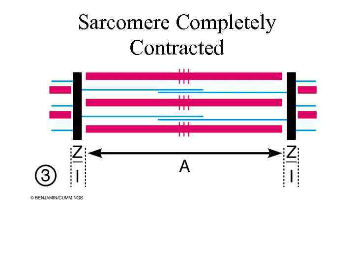 Sarcomere Completely Contracted 