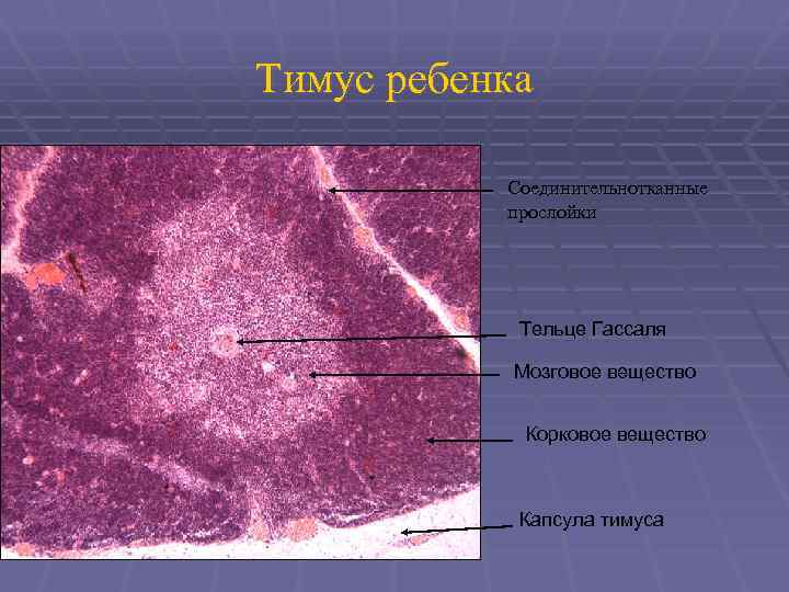 Тимус ребенка Соединительнотканные прослойки Тельце Гассаля Мозговое вещество Корковое вещество Капсула тимуса 