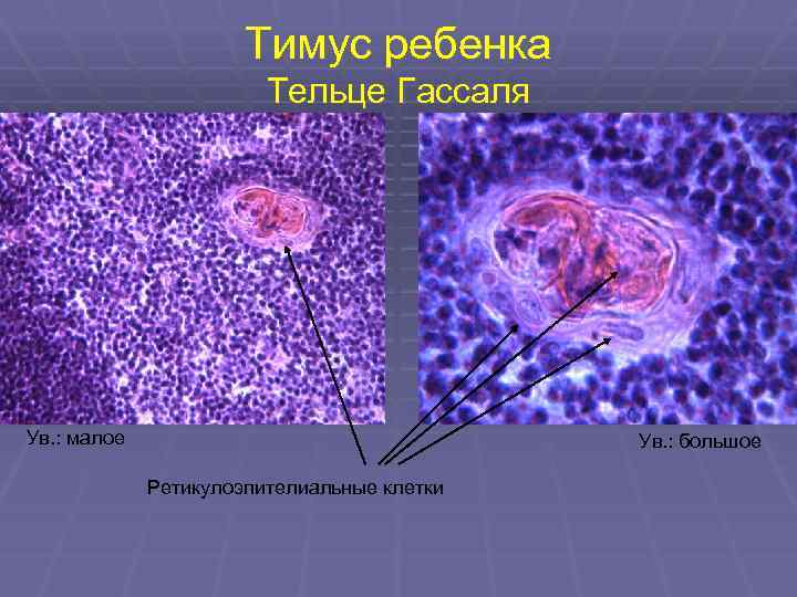 Тельца гассаля гистология