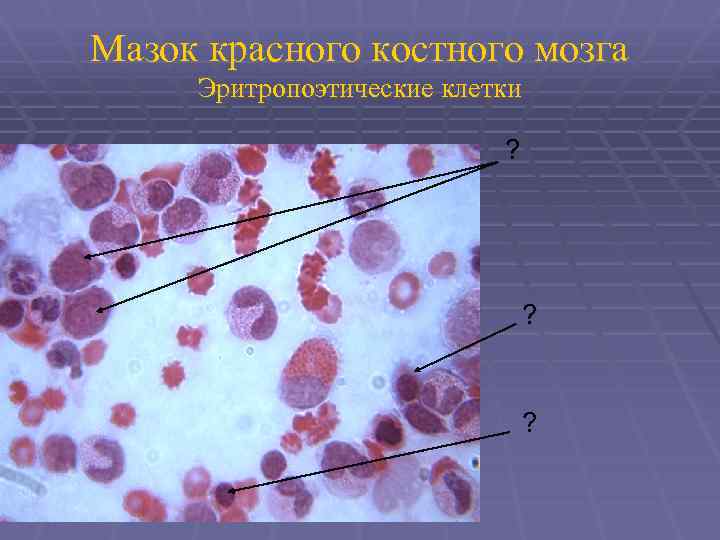 Мазок красного костного мозга Эритропоэтические клетки ? ? ? 