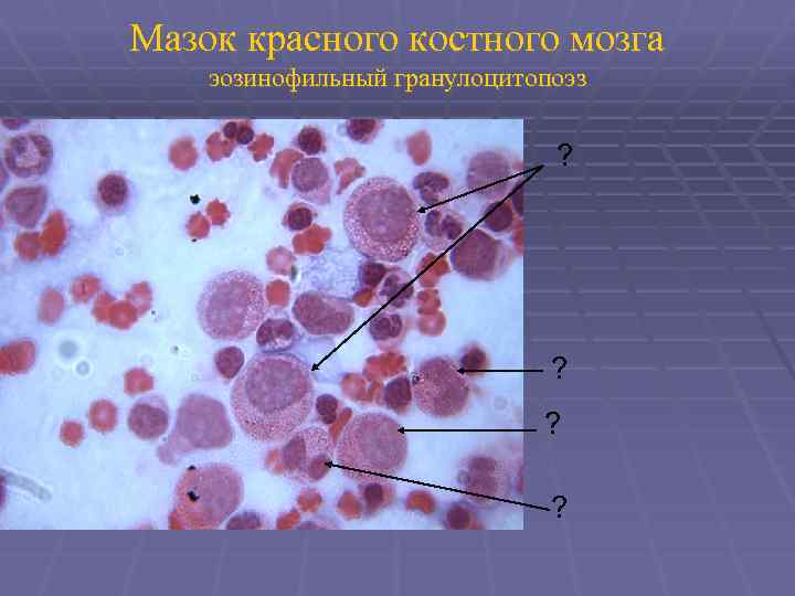 По изображению с микроскопа в строме кроветворного органа человека обнаружены мегакариоциты