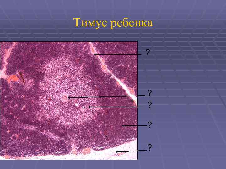 Тимус ребенка ? ? ? 