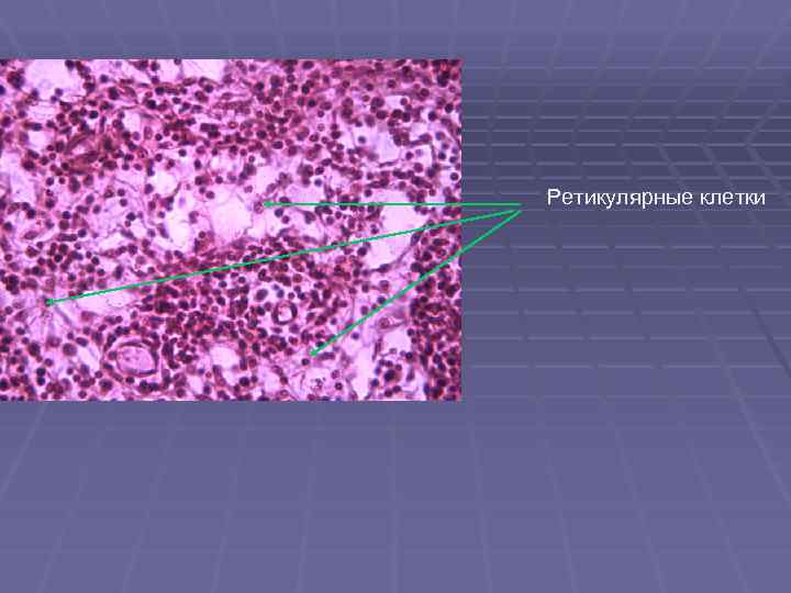 Ретикулярные клетки 