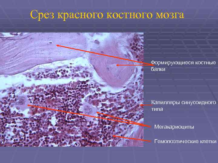 Срез красного костного мозга Формирующиеся костные балки Капилляры синусоидного типа Мегакариоциты Гемопоэтические клетки 