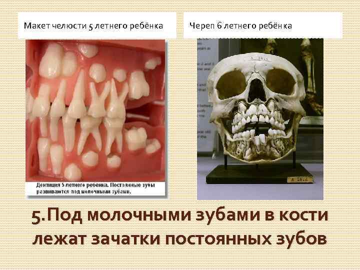 Макет челюсти 5 летнего ребёнка Череп 6 летнего ребёнка 5. Под молочными зубами в