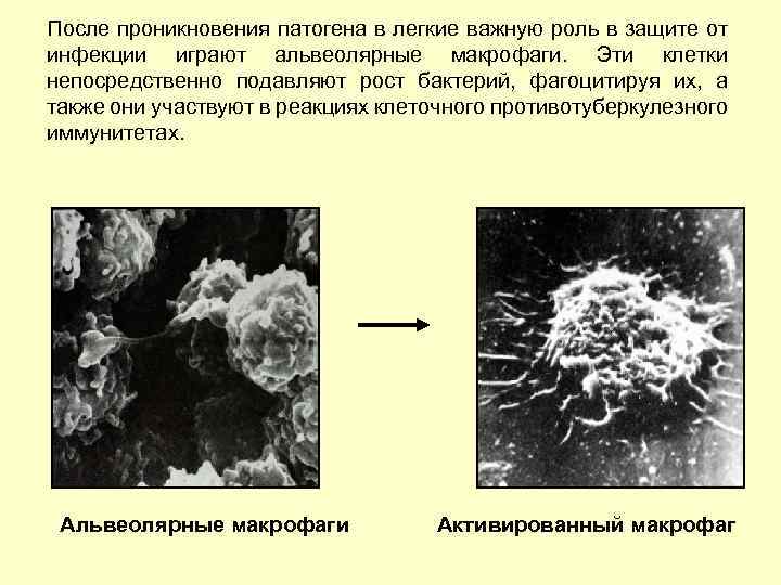 После проникновения патогена в легкие важную роль в защите от инфекции играют альвеолярные макрофаги.