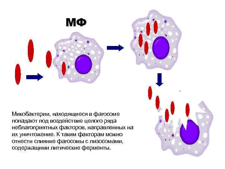 МФ Микобактерии, находящиеся в фагосоме попадают под воздействие целого ряда неблагоприятных факторов, направленных на