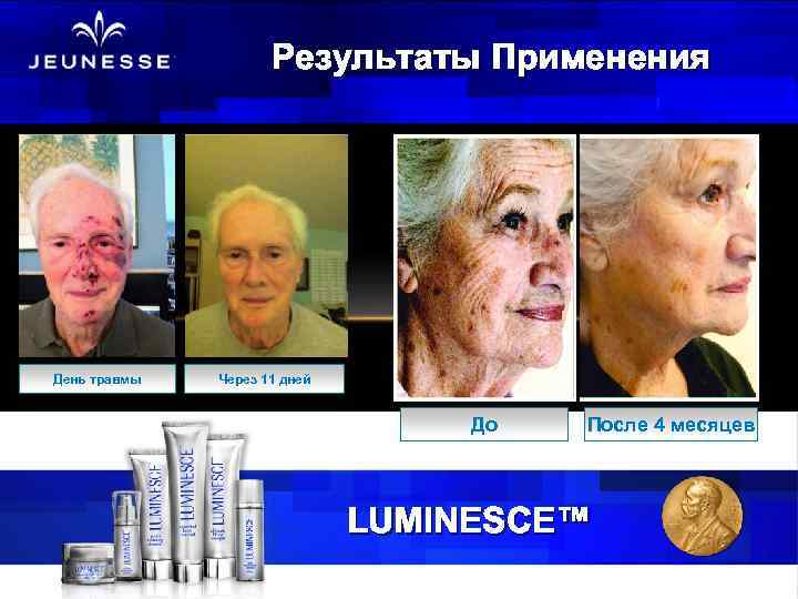 Результаты Применения День травмы Через 11 дней До После 4 месяцев LUMINESCE™ 